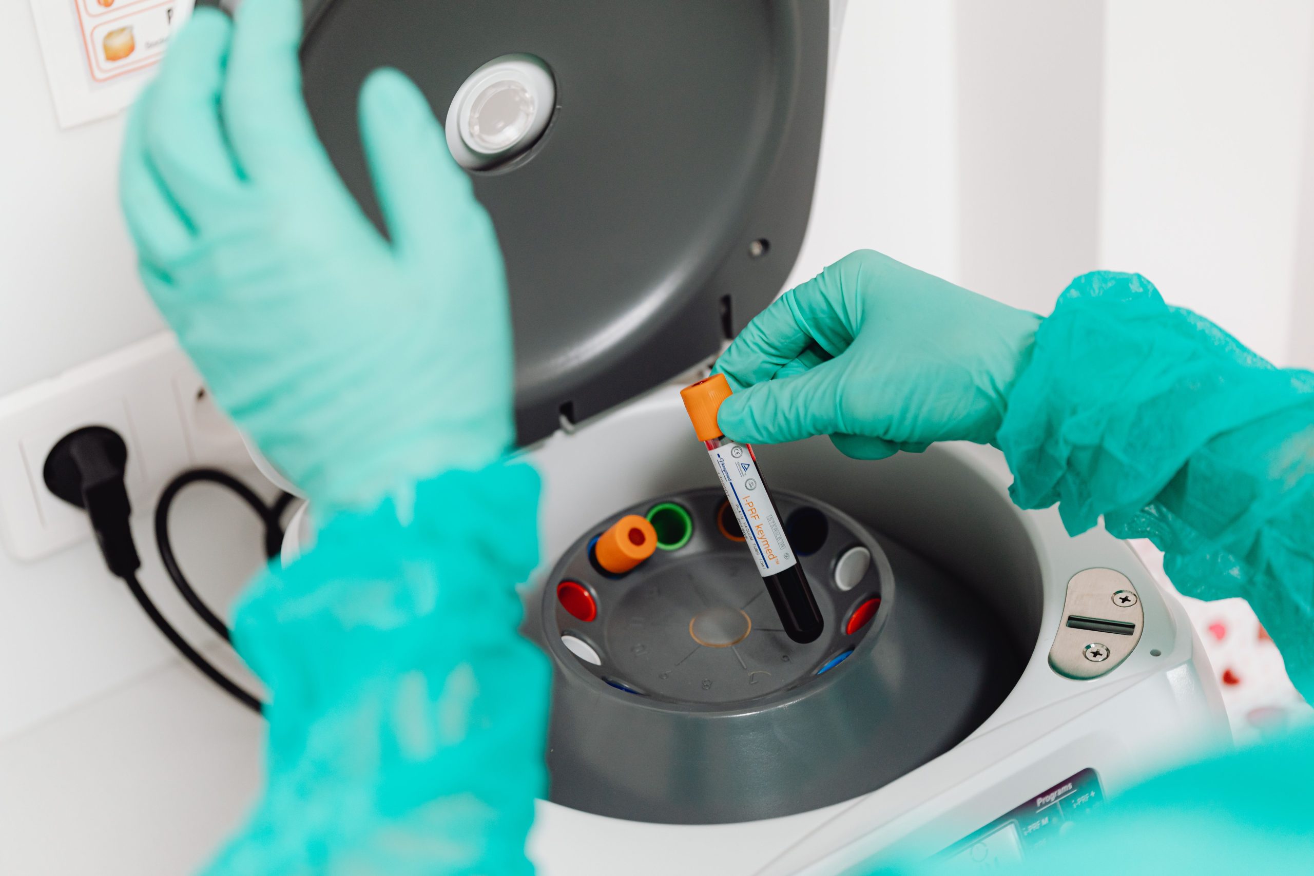 Test Mikrobiomu GutCheck